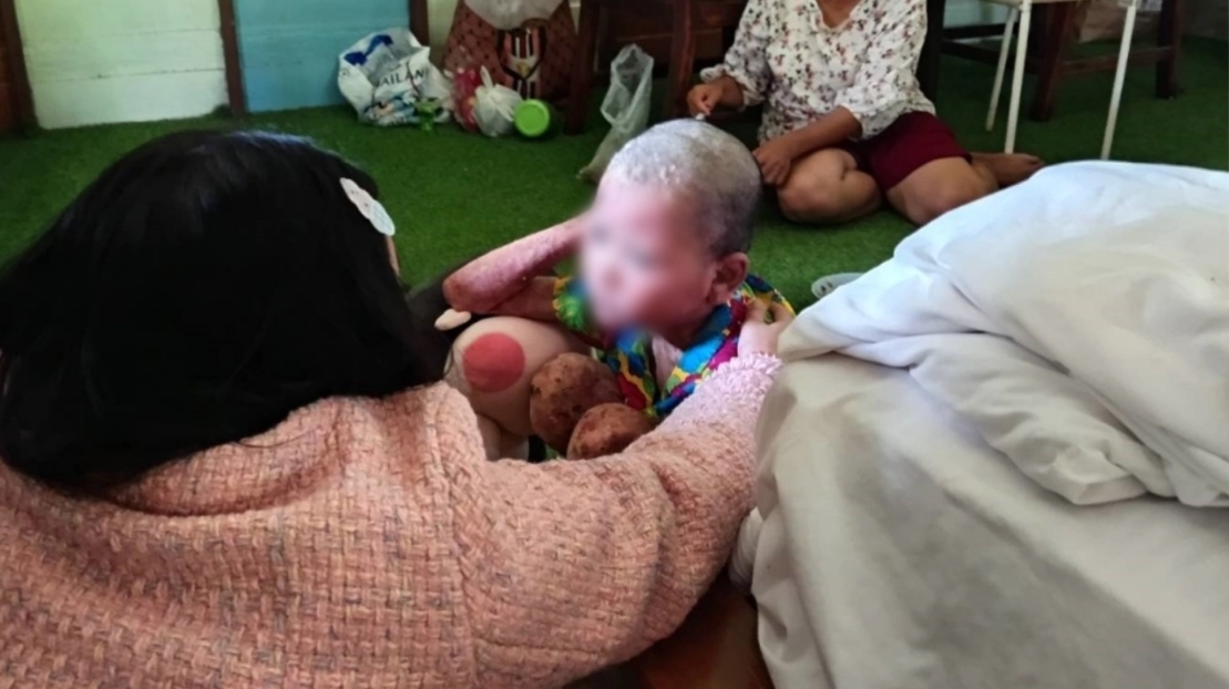 ช่วย "น้องน้ำปั่น" เด็กวัย 12 ปี ป่วยตุ่มน้ำพอง ทรมานกว่า 6 ปี หวังได้กลับไปเรียนต่อ