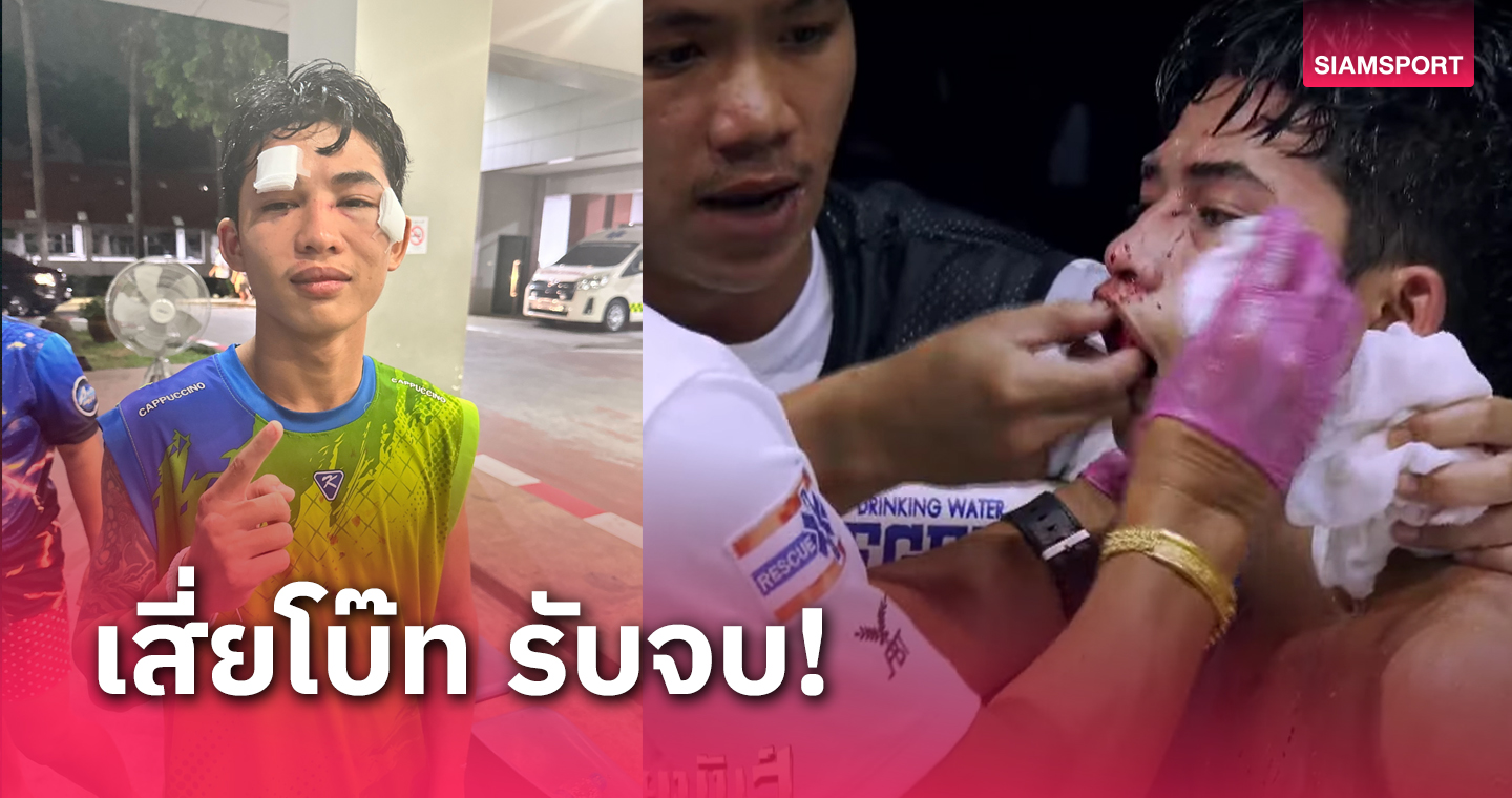 "เสี่ยโบ๊ท" รับผิดชอบค่าใช้จ่ายทุกบาท เหตุ "ภูดาว ลูกสวน" จมูกหักหนัก