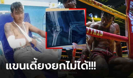 สุดบอบช้ำ! เปิดภาพ "ทูน เทียรา" มวยเขมรเบอร์ 1 หลังโดนมวยไทยจัดหนัก