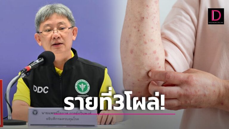 ด่วนที่สุด! สธ.แถลงพบคนป่วยฝีดาษลิงรายที่ 3 โผล่ภูเก็ต เร่งตามกลุ่มเสี่ยง 