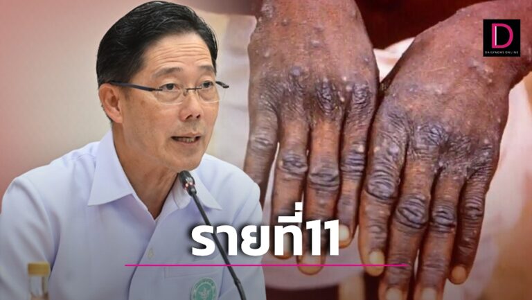 ฝีดาษลิงรายที่ 11 โผล่! ชายไทยอายุ40 ปีกลับจากทำงานนวดที่กาตาร์ 