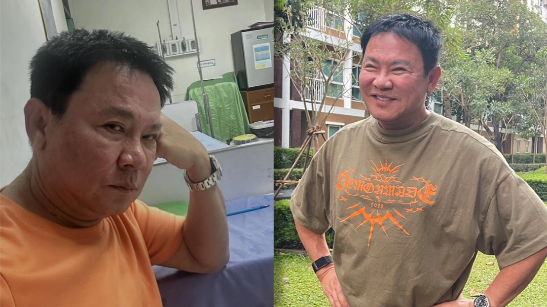 จตุรงค์ มกจ๊ก เกือบตลกไม่ออก เป็นโรคประหลาด สะอึกไม่หยุดนาน 8 ชม. หวั่นอันตรายถึงชีวิต