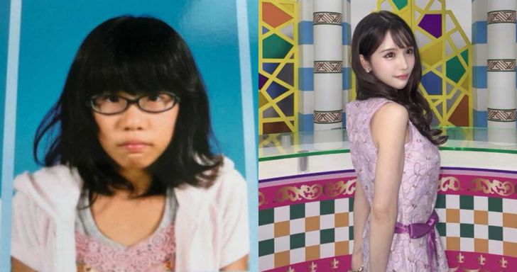 เด็กสาวถูกบูลลี่หน้า แม่ยังด่า "ไม่น่าคลอดออกมา" ล่าสุดเผยรูปหลังศัลยกรรม!